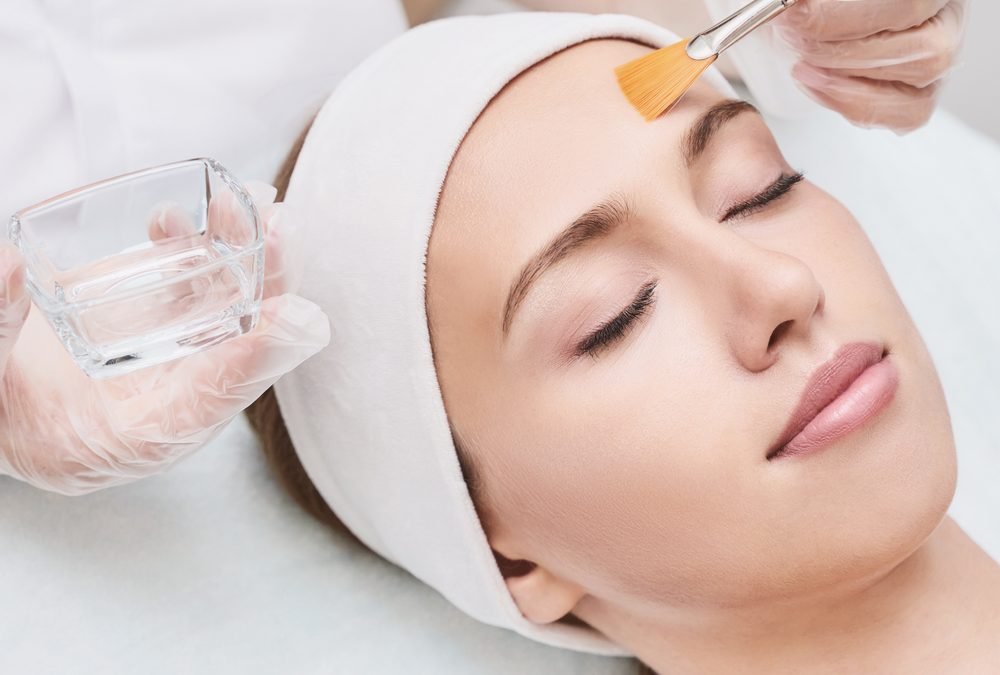 Chemical Peel